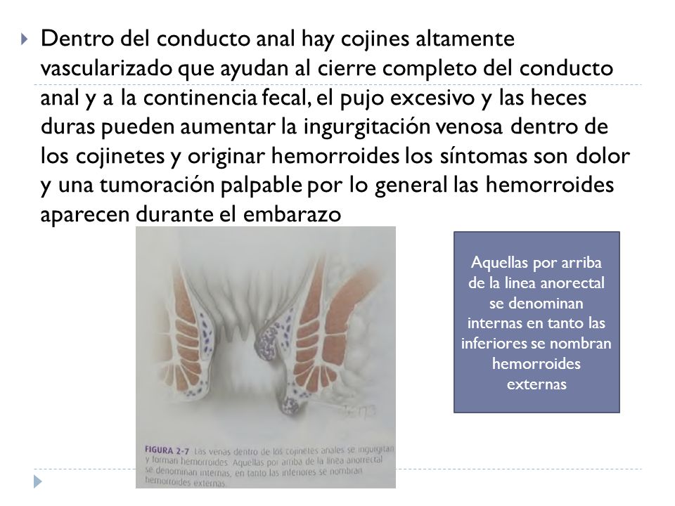 Dentro del conducto anal hay cojines altamente vascularizado que ayudan al cierre completo del conducto anal y a la continencia fecal, el pujo excesivo y las heces duras pueden aumentar la ingurgitación venosa dentro de los cojinetes y originar hemorroides los síntomas son dolor y una tumoración palpable por lo general las hemorroides aparecen durante el embarazo