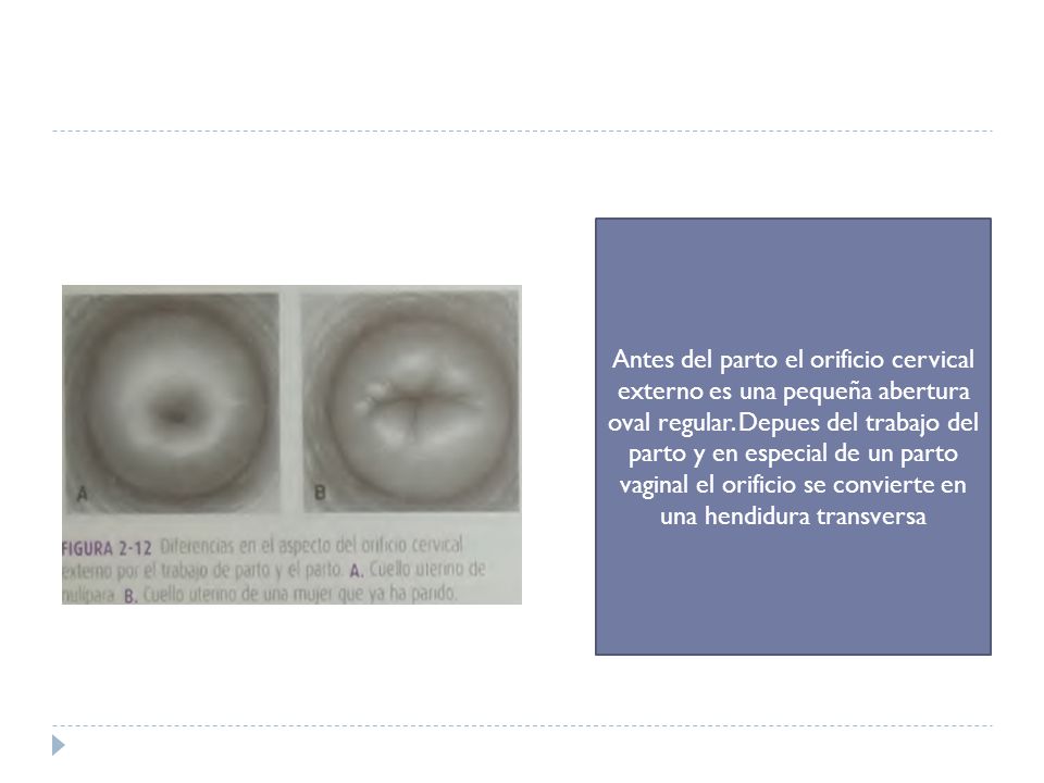 Antes del parto el orificio cervical externo es una pequeña abertura oval regular.