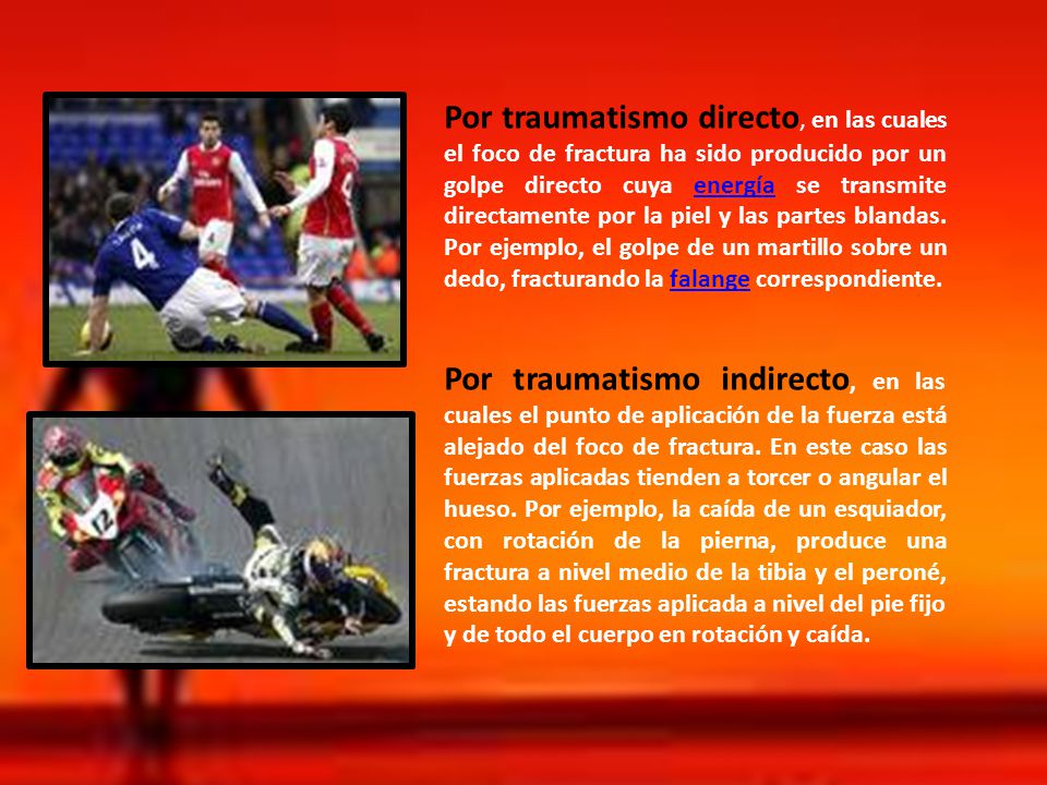 Por traumatismo directo, en las cuales el foco de fractura ha sido producido por un golpe directo cuya energía se transmite directamente por la piel y las partes blandas. Por ejemplo, el golpe de un martillo sobre un dedo, fracturando la falange correspondiente.