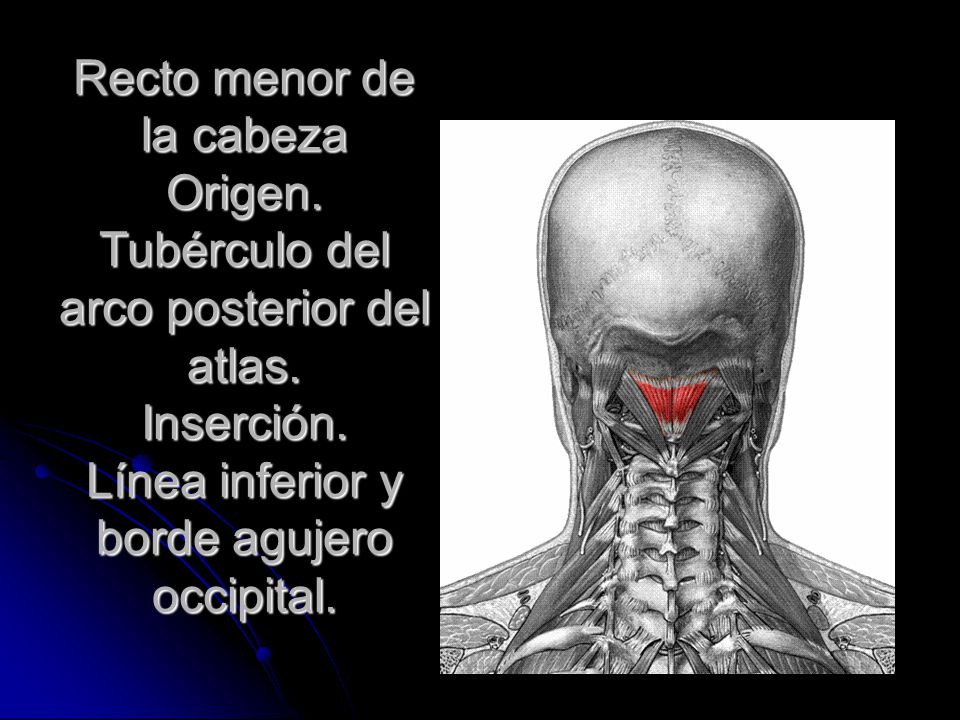 Recto menor de la cabeza Origen. Tubérculo del arco posterior del atlas.