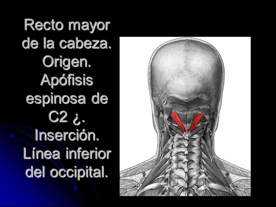 Recto mayor de la cabeza. Origen. Apófisis espinosa de C2 ¿. Inserción