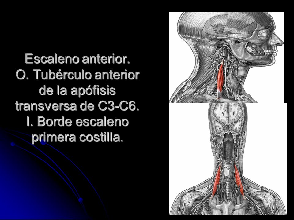 Escaleno anterior. O. Tubérculo anterior de la apófisis transversa de C3-C6.
