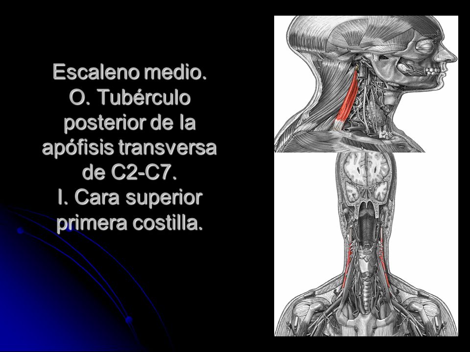 Escaleno medio. O. Tubérculo posterior de la apófisis transversa de C2-C7.