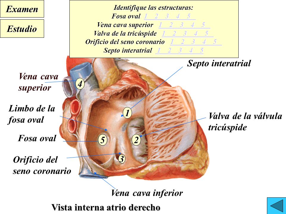 Identifique las estructuras: Orificio del seno coronario