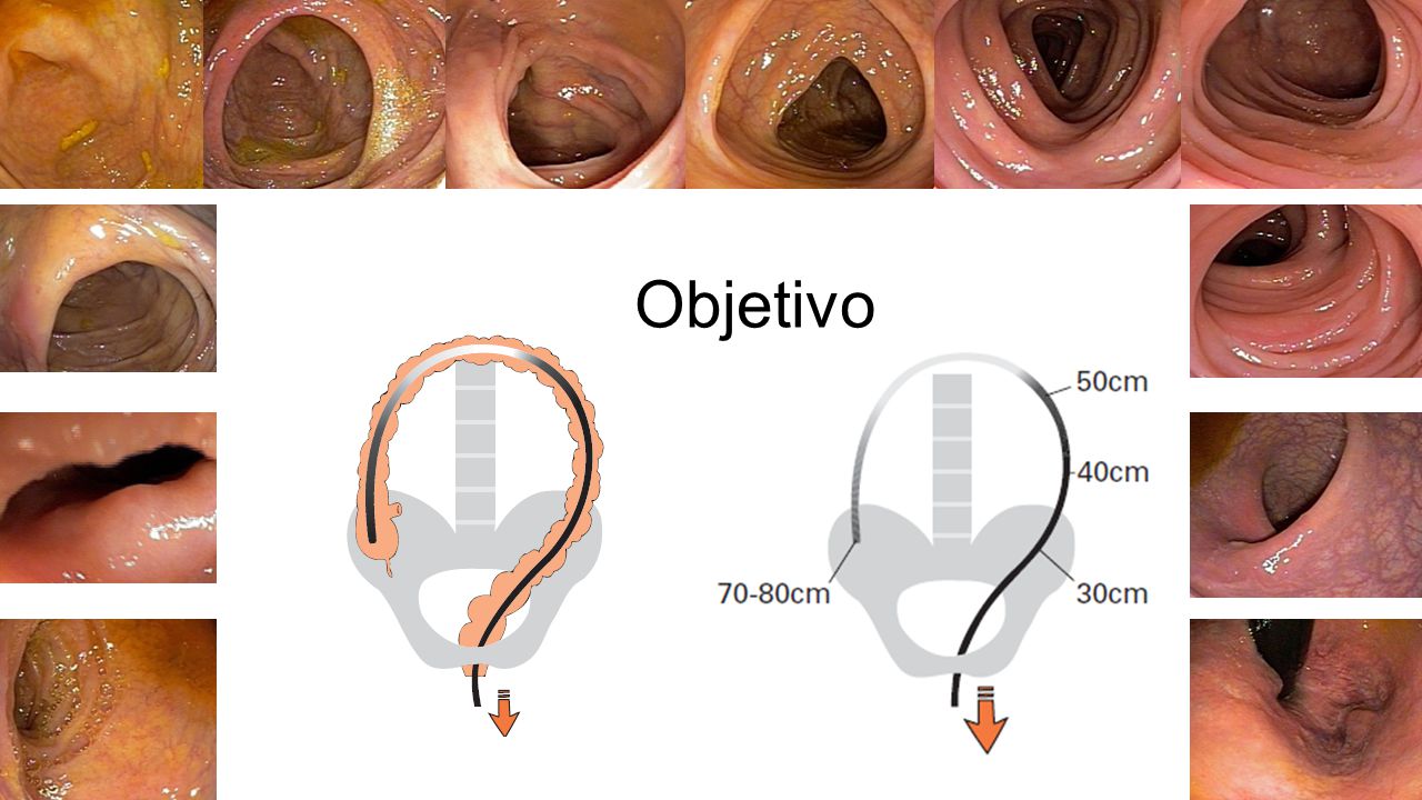 Objetivo