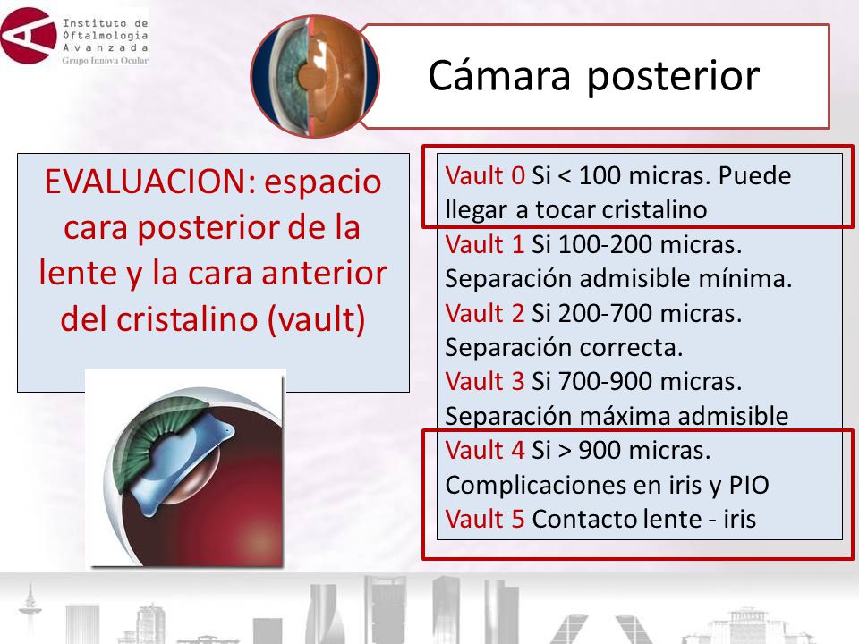 Cámara posterior EVALUACION: espacio cara posterior de la lente y la cara anterior del cristalino (vault)