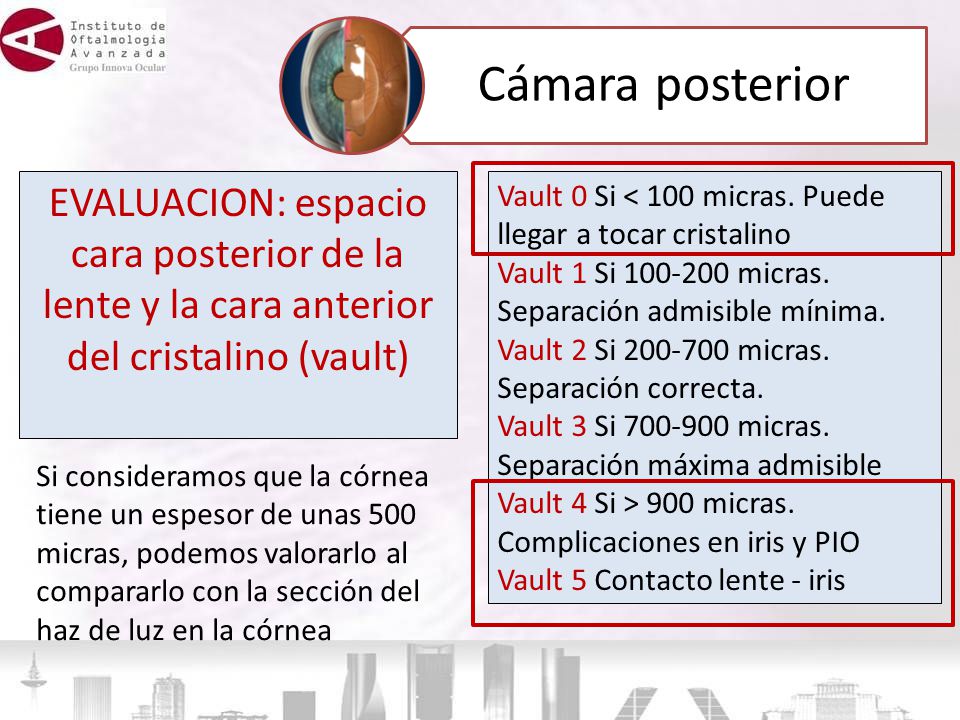 Cámara posterior EVALUACION: espacio cara posterior de la lente y la cara anterior del cristalino (vault)