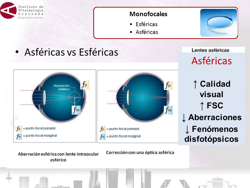 alarma dolor de cabeza papa Lentes intraoculares: tipos y calidad de visión en función del diseño - ppt descargar alarma dolor de cabeza papa Lentes intraoculares: tipos y calidad de visión en función del diseño - ppt descargar