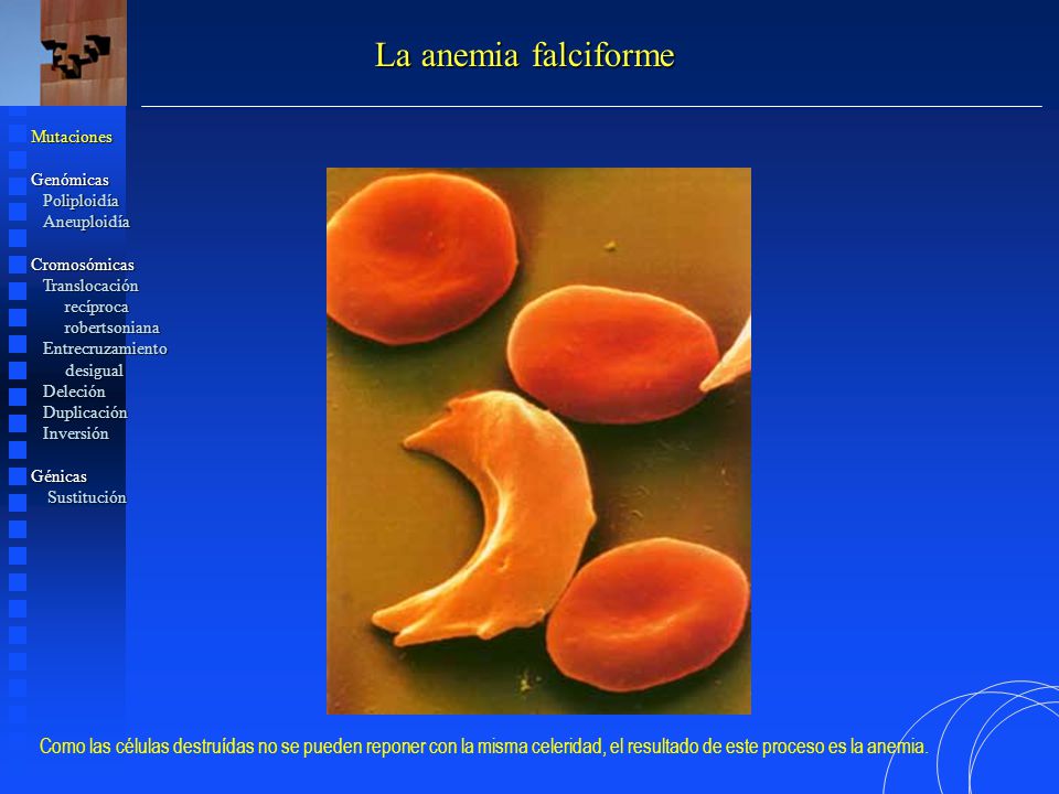 La anemia falciforme Mutaciones. Genómicas. Poliploidía. Aneuploidía. Cromosómicas. Translocación.