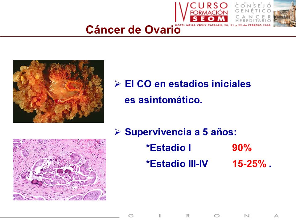 Cáncer de Ovario El CO en estadios iniciales es asintomático.