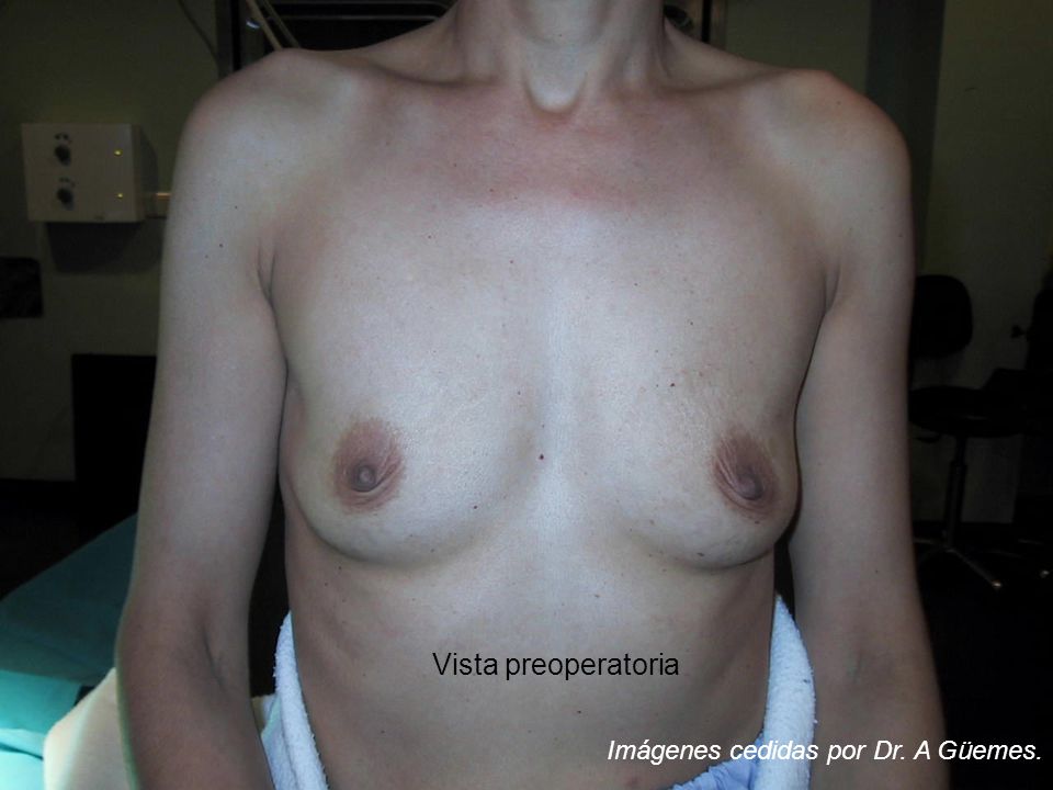 Vista preoperatoria Imágenes cedidas por Dr. A Güemes.