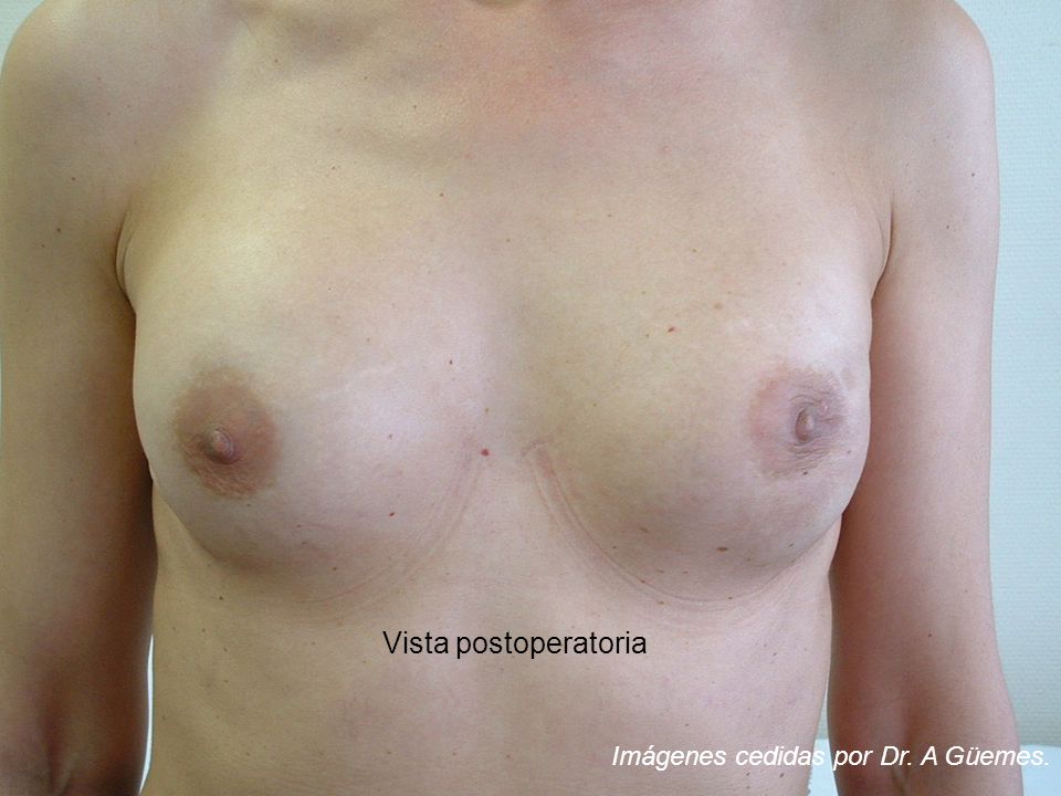Vista postoperatoria Imágenes cedidas por Dr. A Güemes.