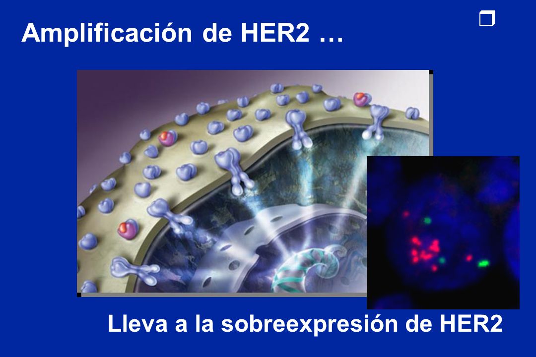 Amplificación de HER2 … Lleva a la sobreexpresión de HER2