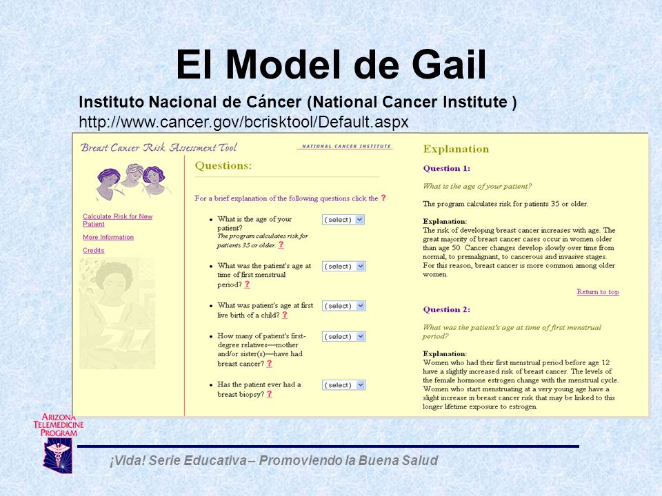 El Model de Gail Instituto Nacional de Cáncer (National Cancer Institute )