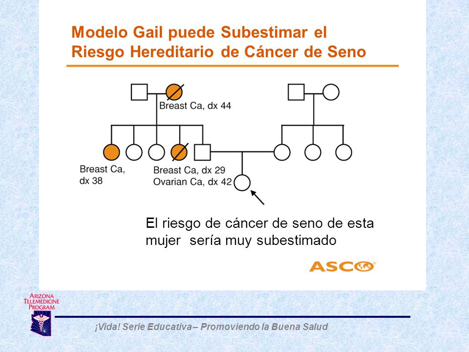 Modelo Gail puede Subestimar el Riesgo Hereditario de Cáncer de Seno