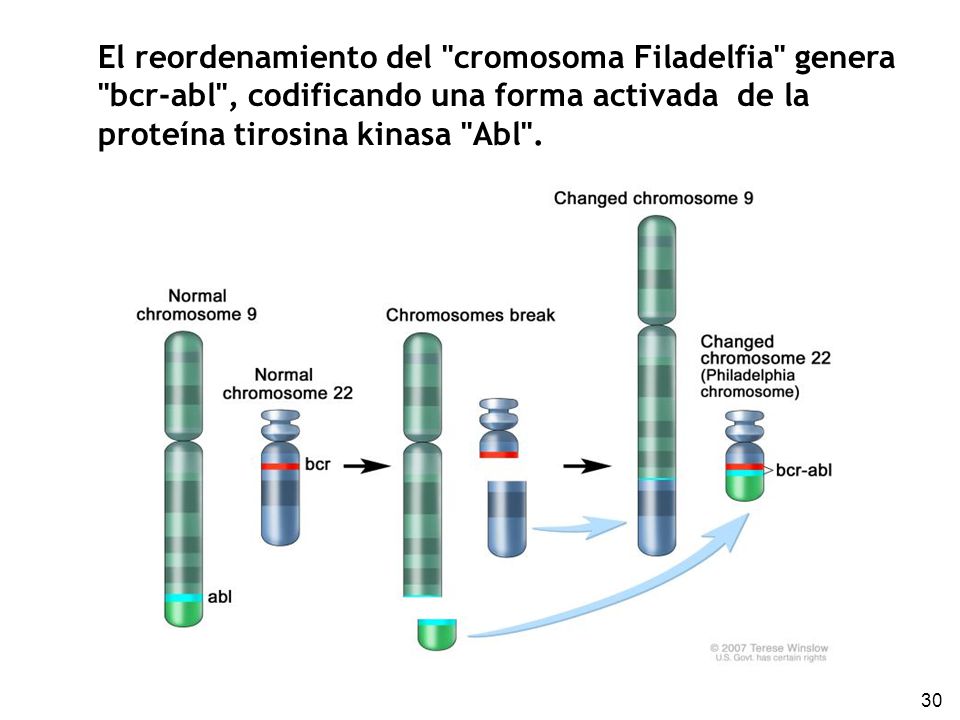 El reordenamiento del cromosoma Filadelfia genera bcr-abl , codificando una forma activada de la proteína tirosina kinasa Abl .