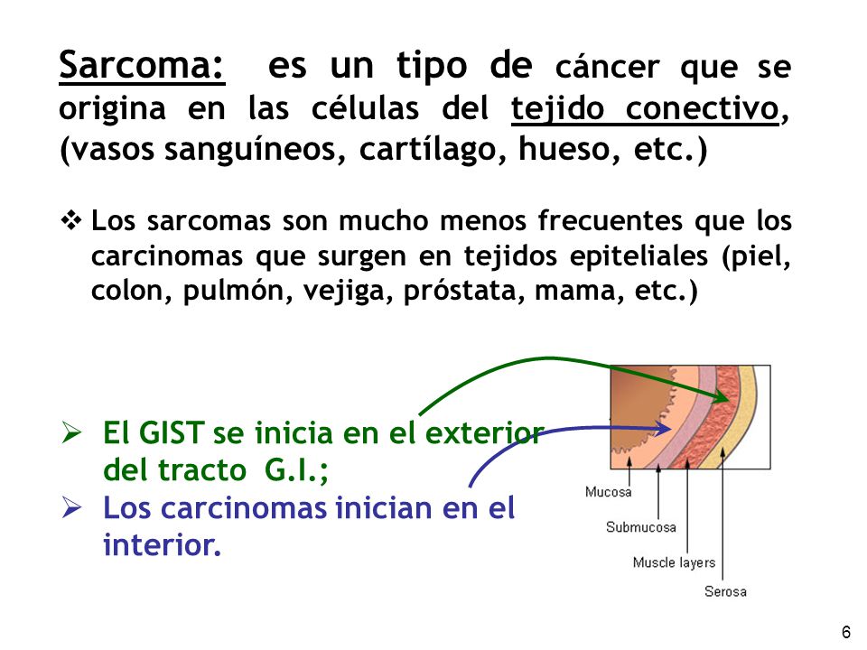 Sarcoma: es un tipo de cáncer que se origina en las células del tejido conectivo, (vasos sanguíneos, cartílago, hueso, etc.)