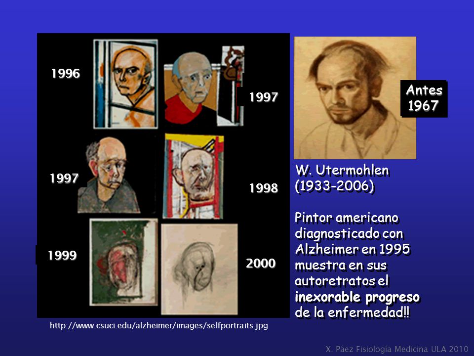 Antes W. Utermohlen ( )