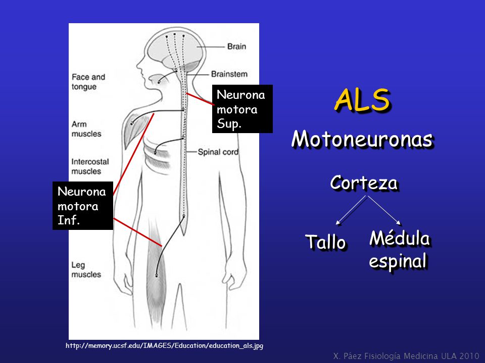 ALS Motoneuronas Corteza Médula Tallo espinal Neurona motora Sup.