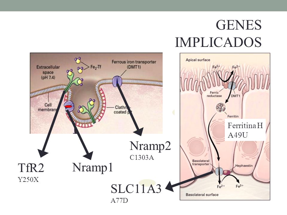 GENES IMPLICADOS Nramp2 TfR2 Nramp1 SLC11A3 Ferritina H A49U C1303A