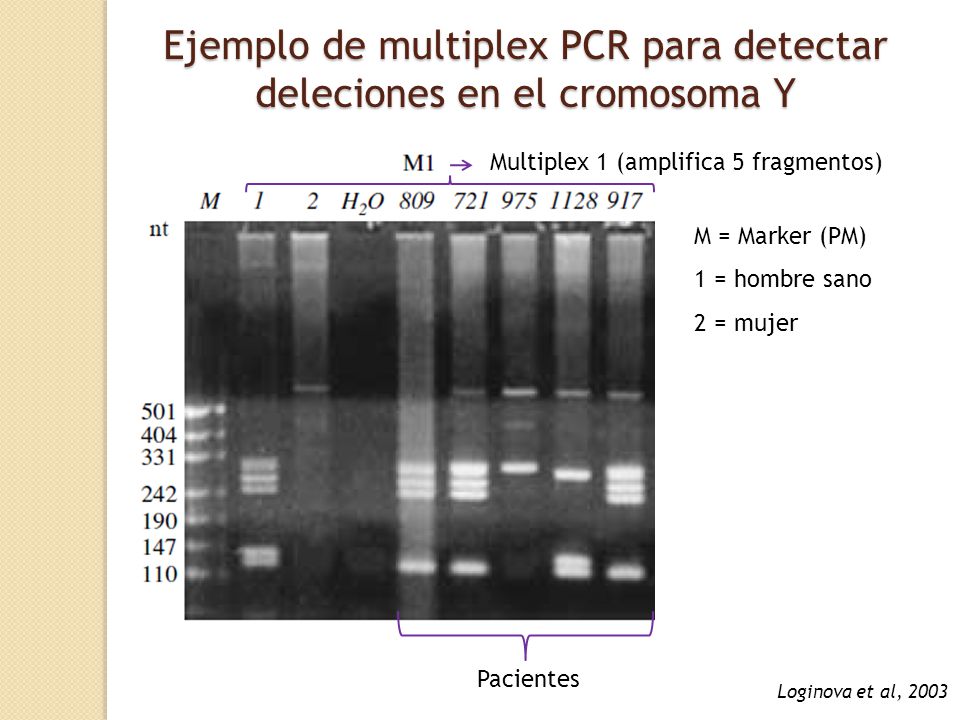 Ejemplo de multiplex PCR para detectar deleciones en el cromosoma Y