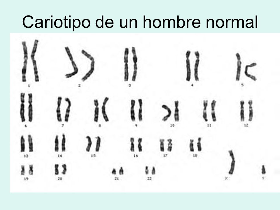 Cariotipo de un hombre normal