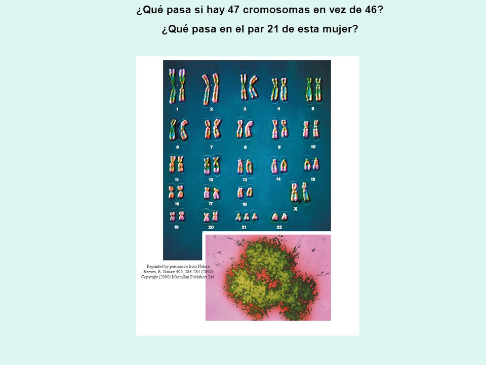¿Qué pasa si hay 47 cromosomas en vez de 46