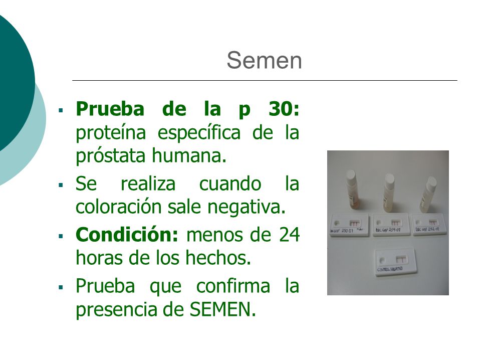 Semen Prueba de la p 30: proteína específica de la próstata humana.