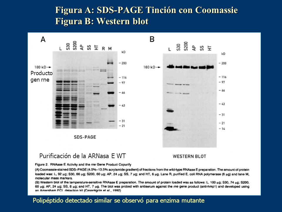 Figura A: SDS-PAGE Tinción con Coomassie Figura B: Western blot