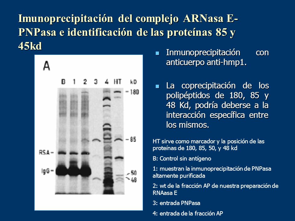 Imunoprecipitación del complejo ARNasa E-PNPasa e identificación de las proteínas 85 y 45kd