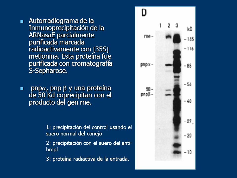 Autorradiograma de la Inmunoprecipitación de la ARNasaE parcialmente purificada marcada radioactivamente con 35S metionina. Esta proteína fue purificada con cromatografía S-Sepharose.