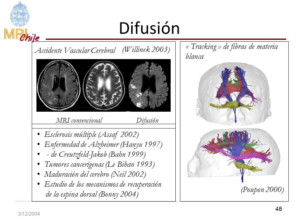 Difusión « Tracking » de fibras de materia (Willinek 2003)