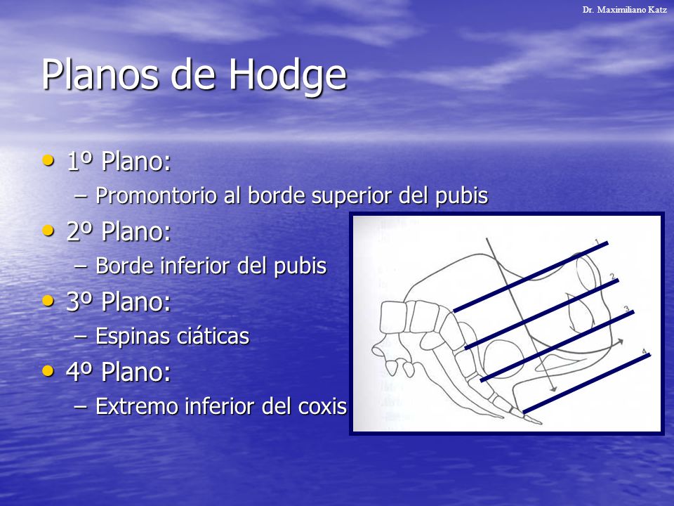 Planos de Hodge 1º Plano: 2º Plano: 3º Plano: 4º Plano: