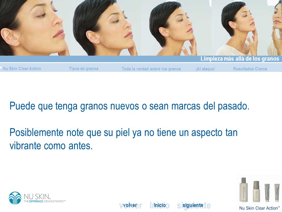 Puede que tenga granos nuevos o sean marcas del pasado