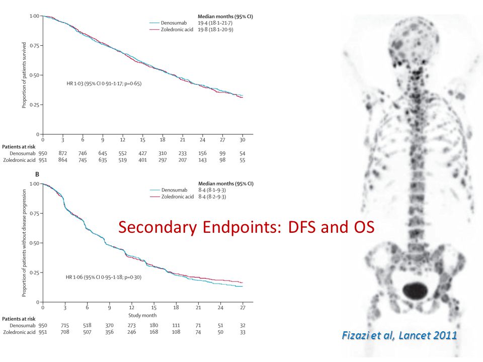 Secondary Endpoints: DFS and OS