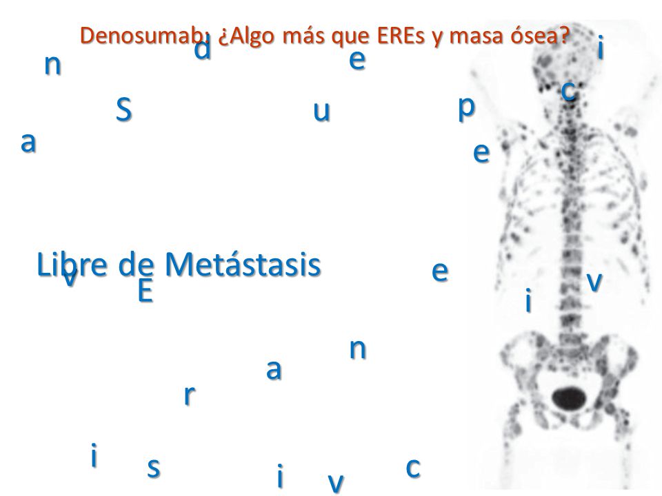 d i e n c p S u a e Libre de Metástasis e v v E i n a r i s c i v
