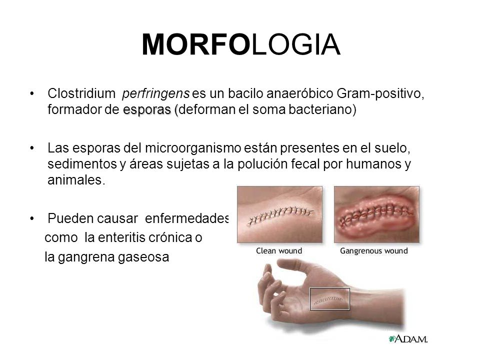 MORFOLOGIA Clostridium perfringens es un bacilo anaeróbico Gram-positivo, formador de esporas (deforman el soma bacteriano)