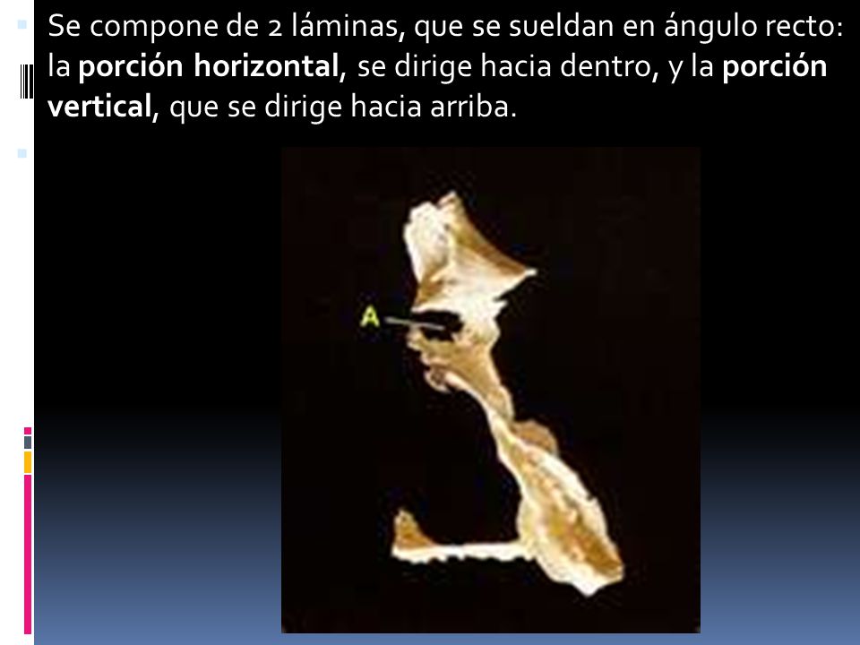 Se compone de 2 láminas, que se sueldan en ángulo recto: la porción horizontal, se dirige hacia dentro, y la porción vertical, que se dirige hacia arriba.