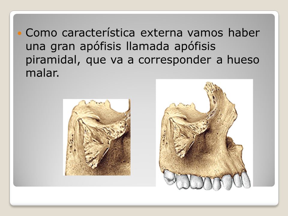 Como característica externa vamos haber una gran apófisis llamada apófisis piramidal, que va a corresponder a hueso malar.
