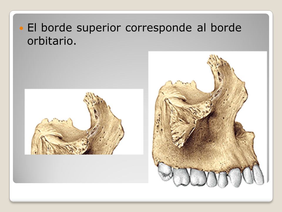 El borde superior corresponde al borde orbitario.