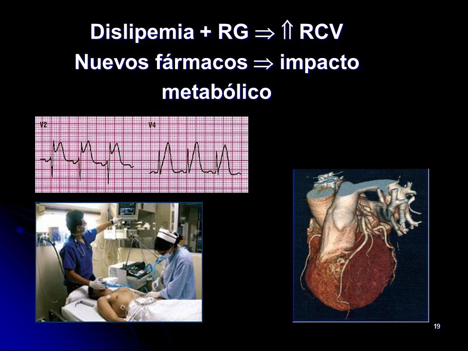 Dislipemia + RG   RCV Nuevos fármacos  impacto metabólico