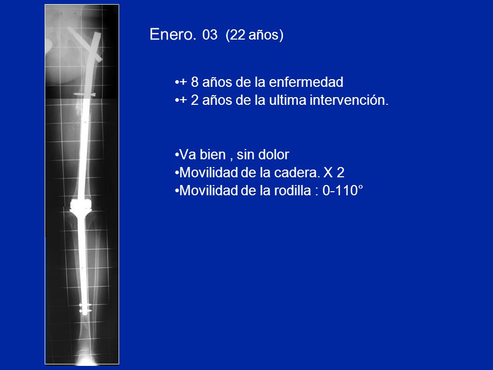 Enero. 03 (22 años) + 8 años de la enfermedad