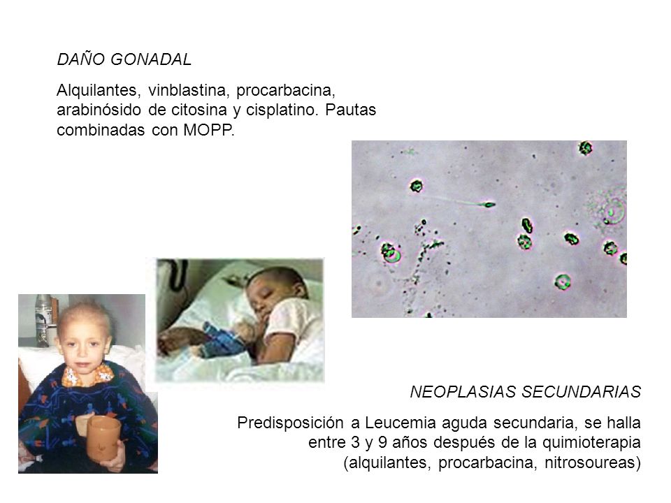DAÑO GONADAL Alquilantes, vinblastina, procarbacina, arabinósido de citosina y cisplatino. Pautas combinadas con MOPP.