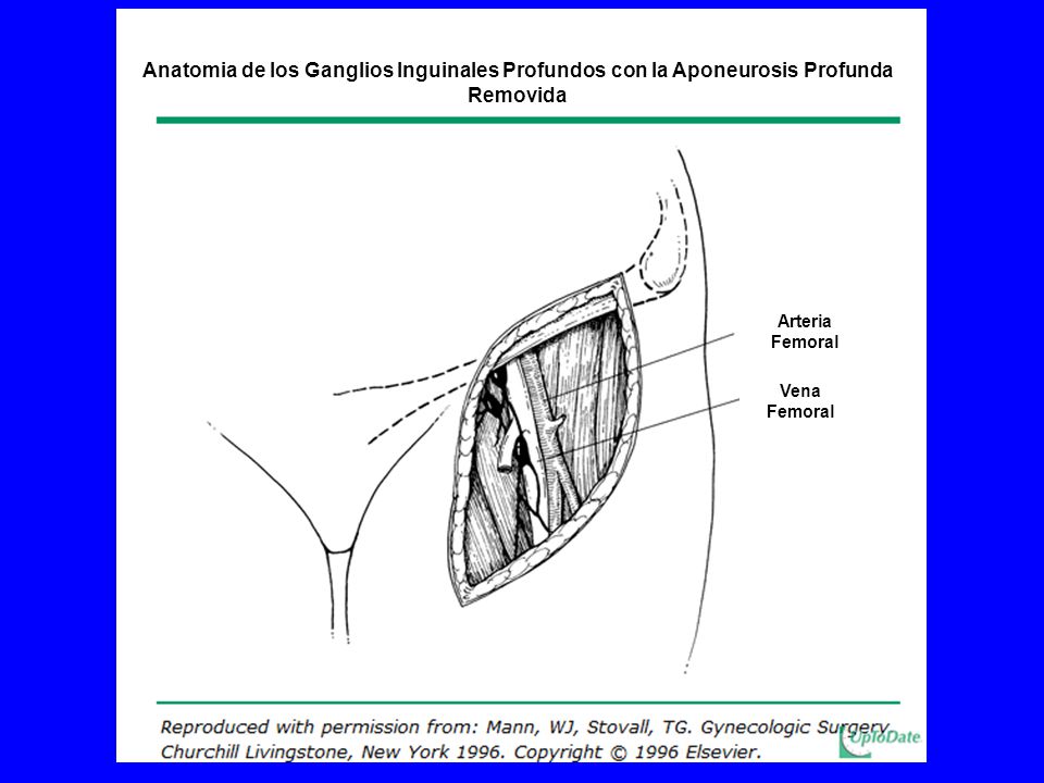 Anatomia de los Ganglios Inguinales Profundos con la Aponeurosis Profunda Removida