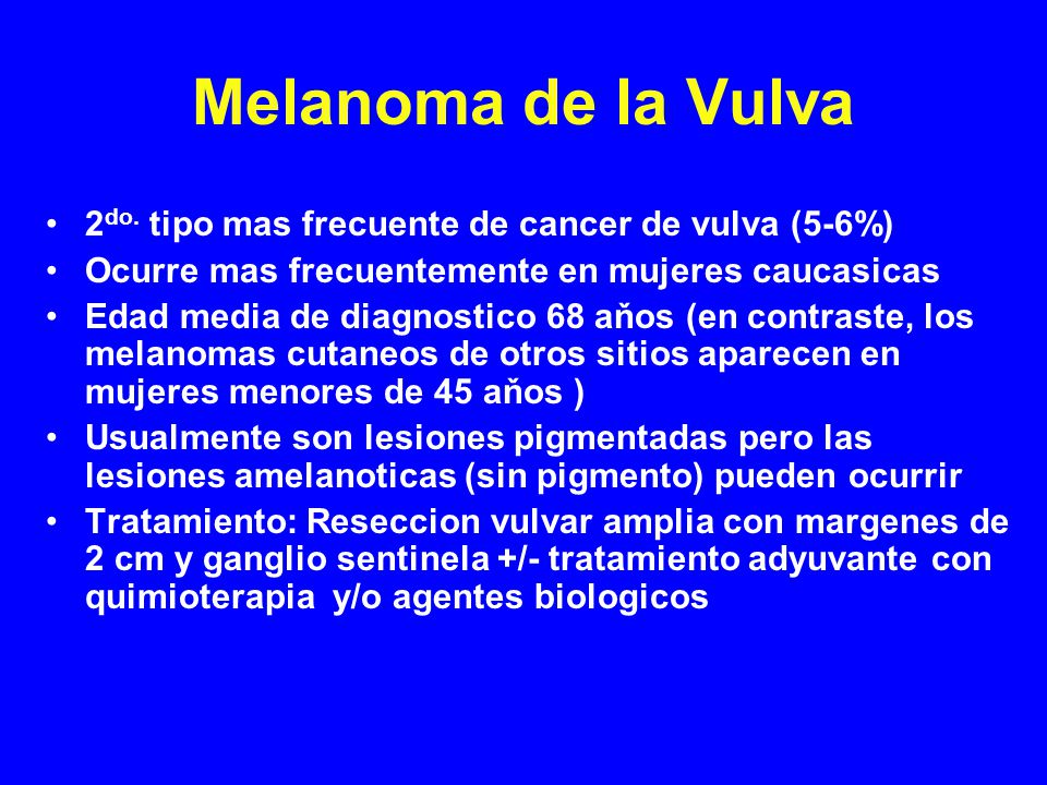 Melanoma de la Vulva 2do. tipo mas frecuente de cancer de vulva (5-6%)