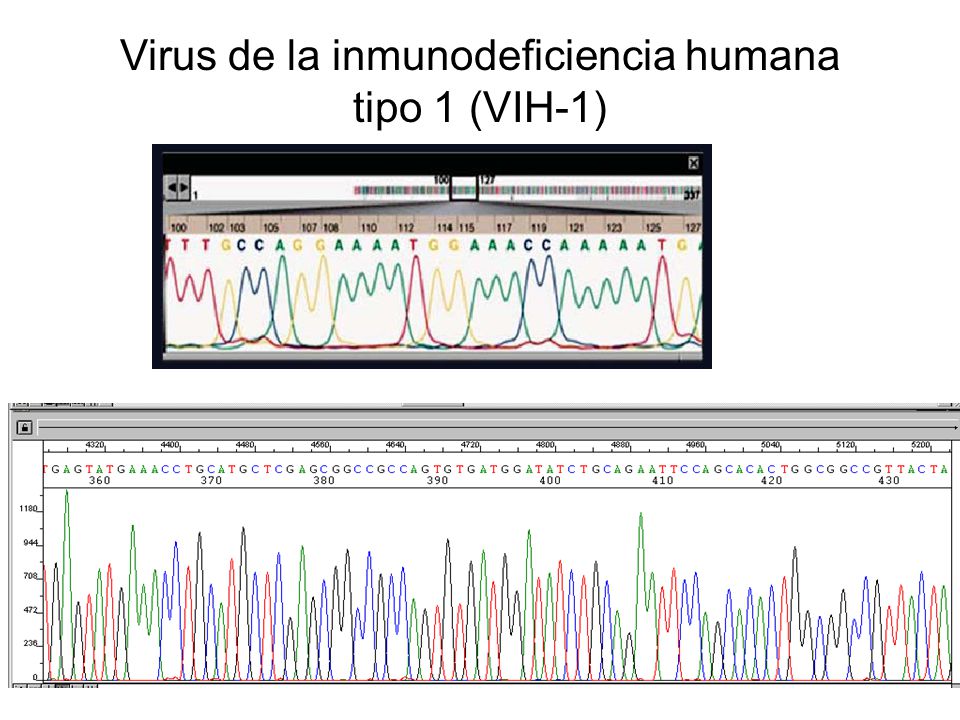 Virus de la inmunodeficiencia humana tipo 1 (VIH-1)