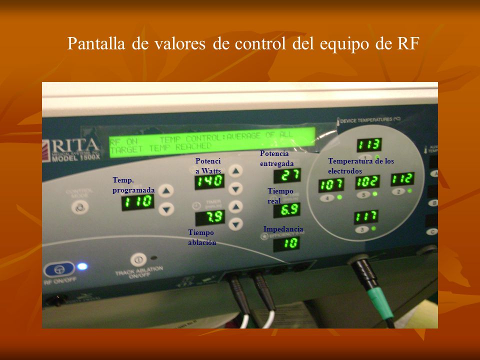 Pantalla de valores de control del equipo de RF