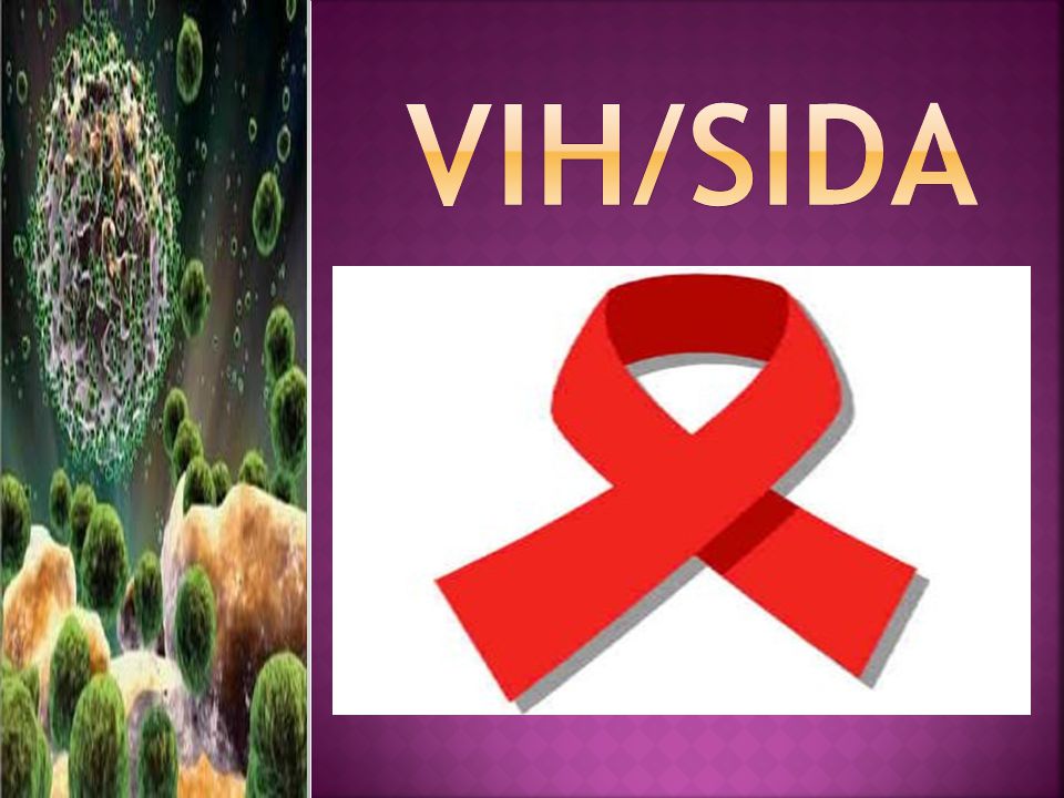 VIH/sida
