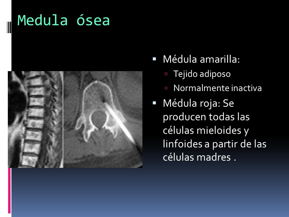 Medula ósea Médula amarilla: