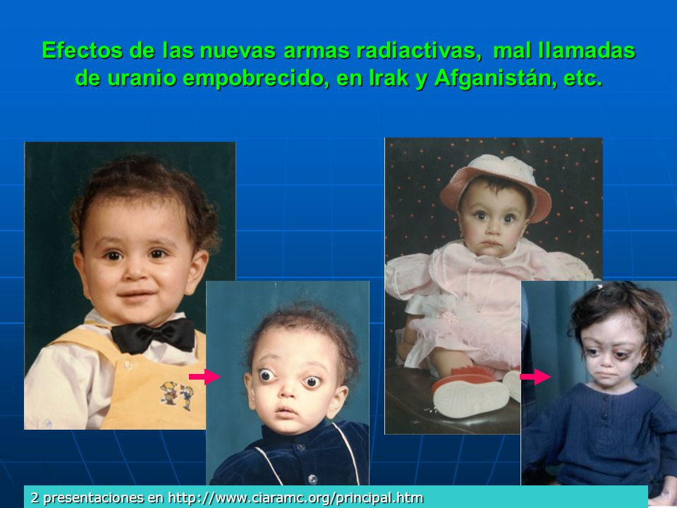 Efectos de las nuevas armas radiactivas, mal llamadas de uranio empobrecido, en Irak y Afganistán, etc.